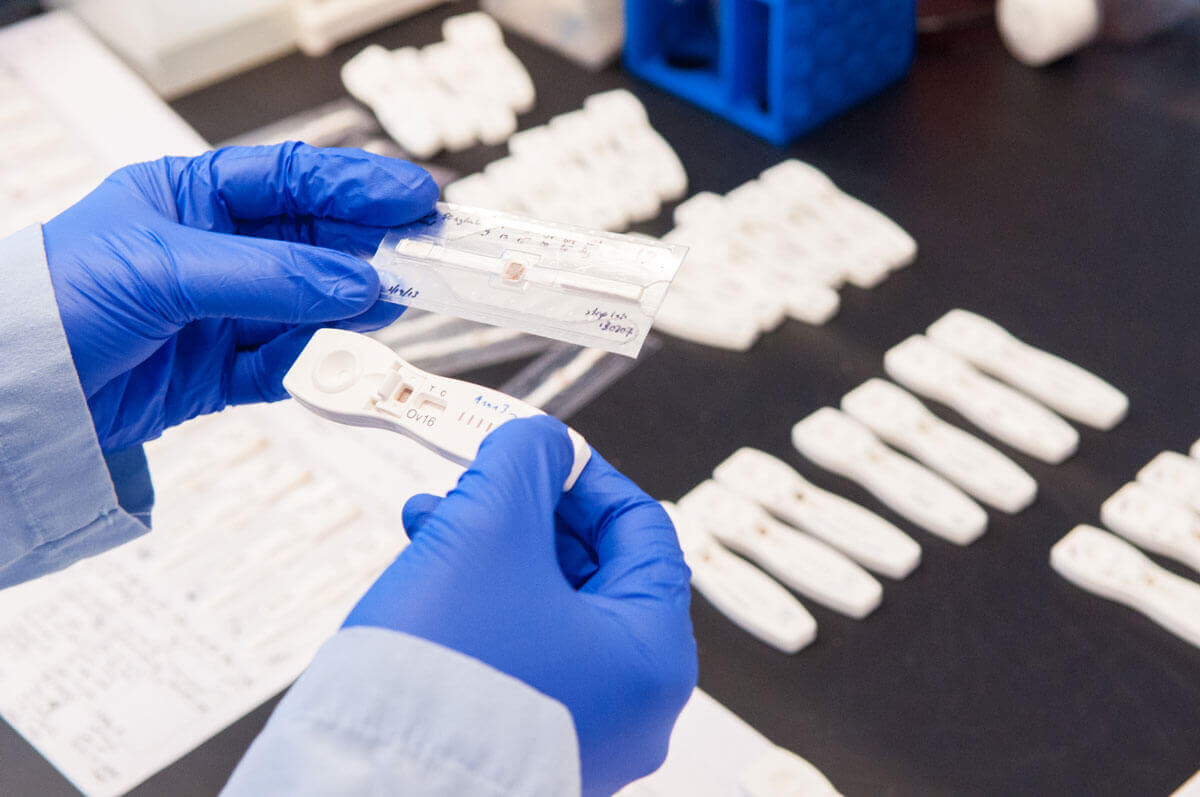 A researcher holds onchocerciasis (river blindness) diagnostic tests. Photo: PATH/Patrick McKern